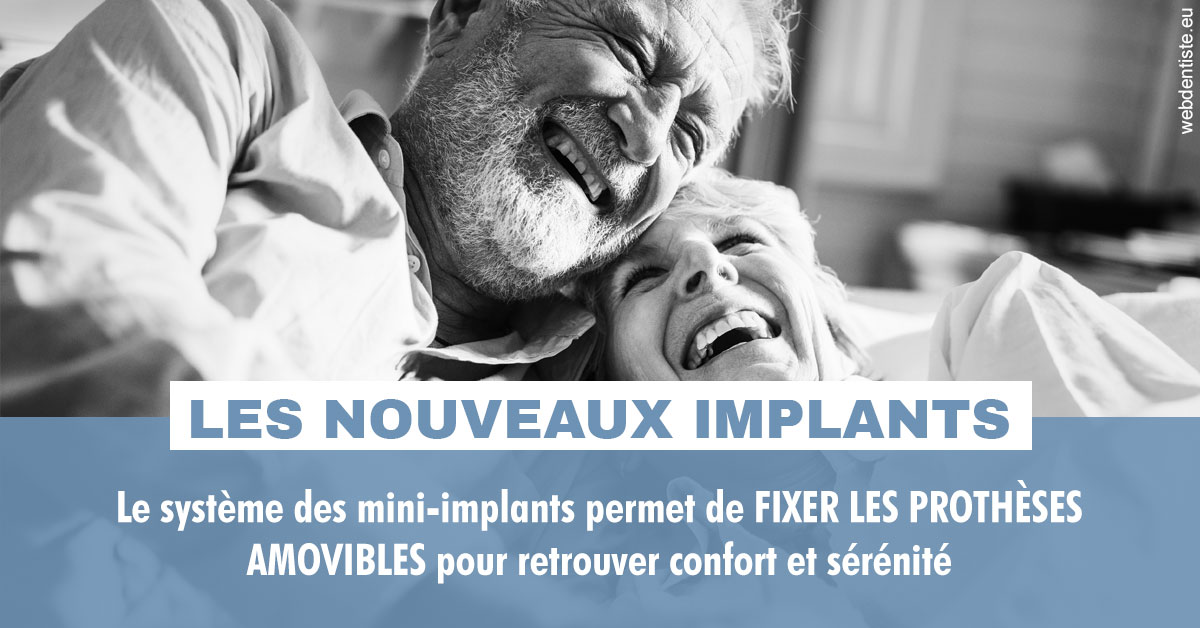 https://www.pedeboscq-pecastaing.fr/Les nouveaux implants 2