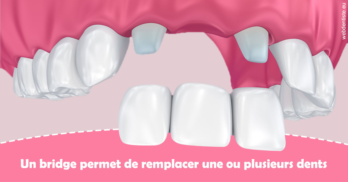 https://www.pedeboscq-pecastaing.fr/Bridge remplacer dents 2