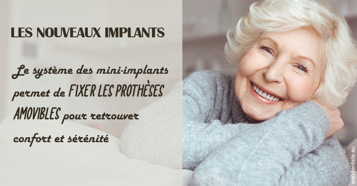https://www.pedeboscq-pecastaing.fr/Les nouveaux implants 1