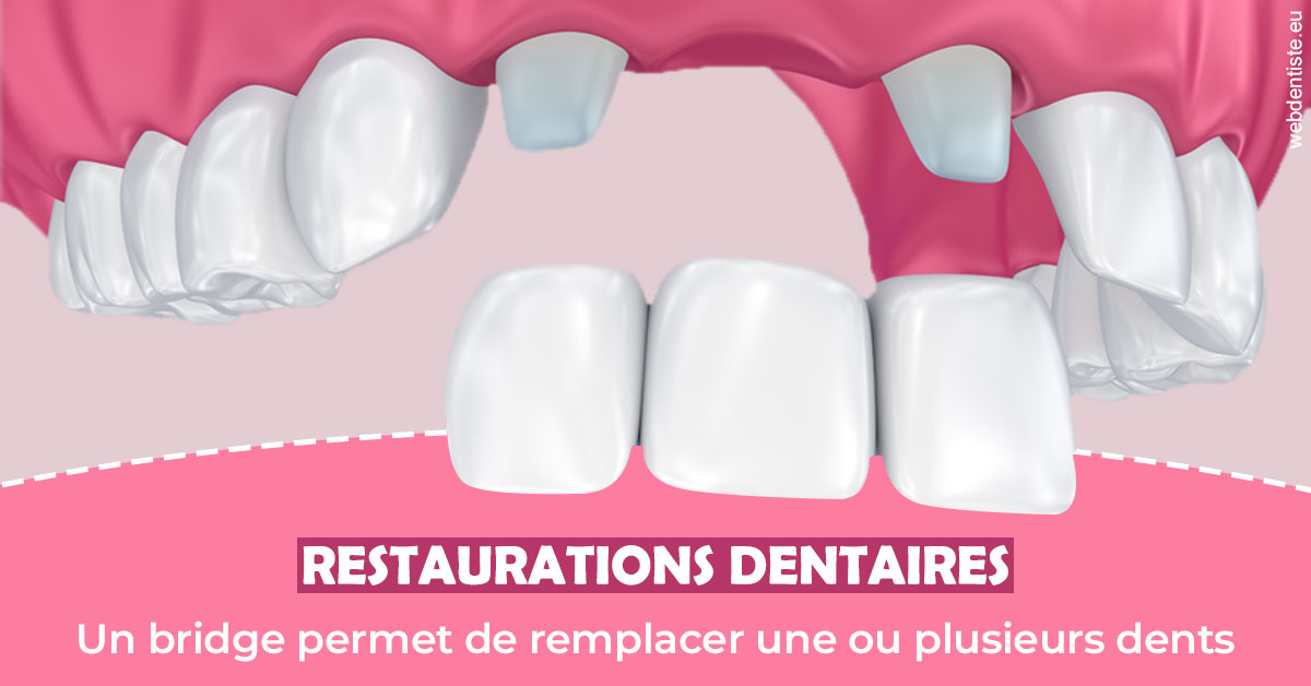 https://www.pedeboscq-pecastaing.fr/Bridge remplacer dents 2