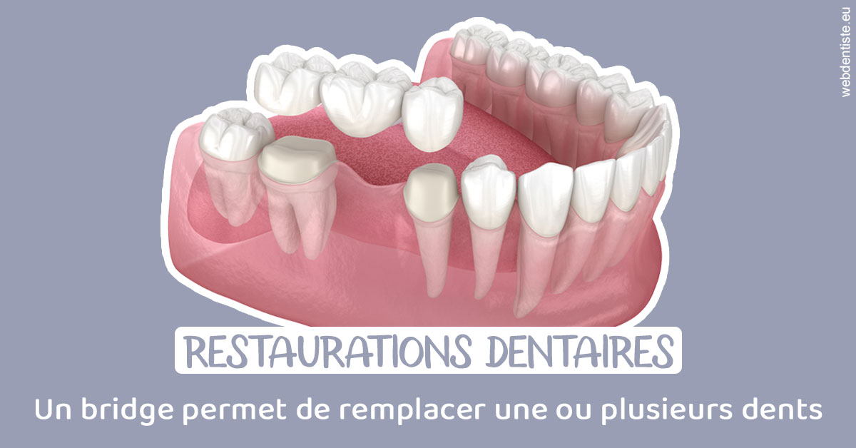 https://www.pedeboscq-pecastaing.fr/Bridge remplacer dents 1