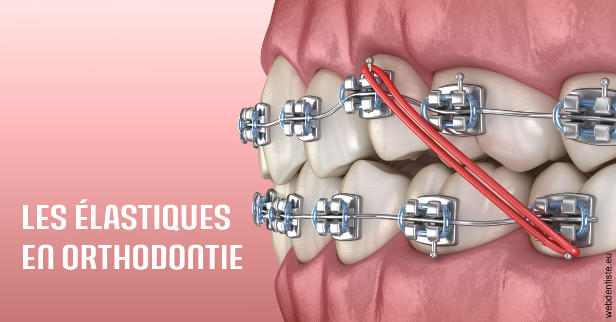https://www.pedeboscq-pecastaing.fr/Elastiques orthodontie 2